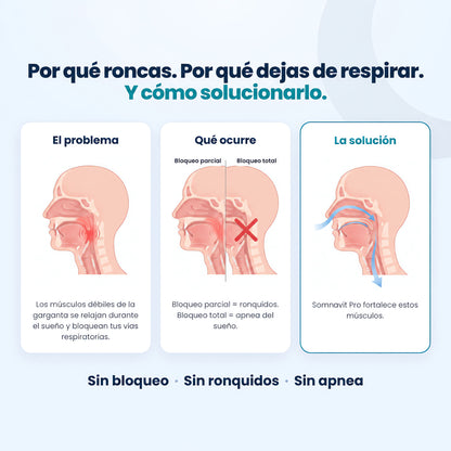 Somnavit Pro™ — Dispositivo para ronquidos y apnea del sueño